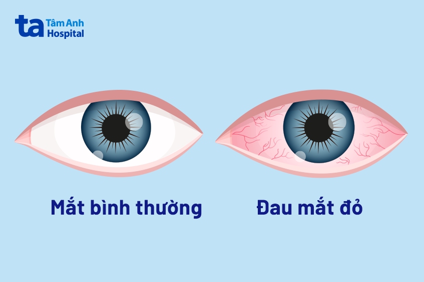 Thị giác là gì? Tầm quan trọng, chức năng và cơ chế hoạt động