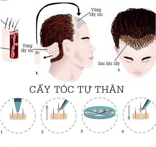 [Giải đáp thắc mắc]: Nuôi tóc dài nam mất bao lâu?