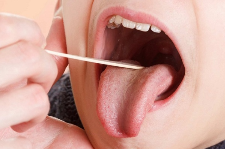 70+ hình le lưỡi đẹp nhất