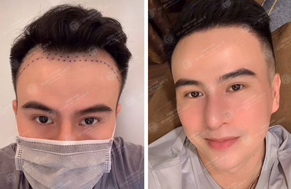 [Giải đáp thắc mắc]: Nuôi tóc dài nam mất bao lâu?