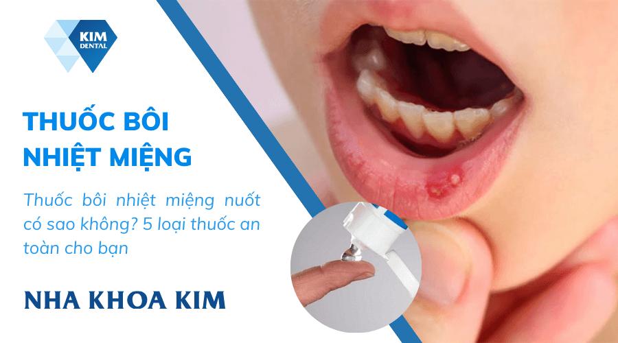 Thuốc bôi nhiệt miệng nuốt có sao không? 5 loại thuốc an toàn cho bạn